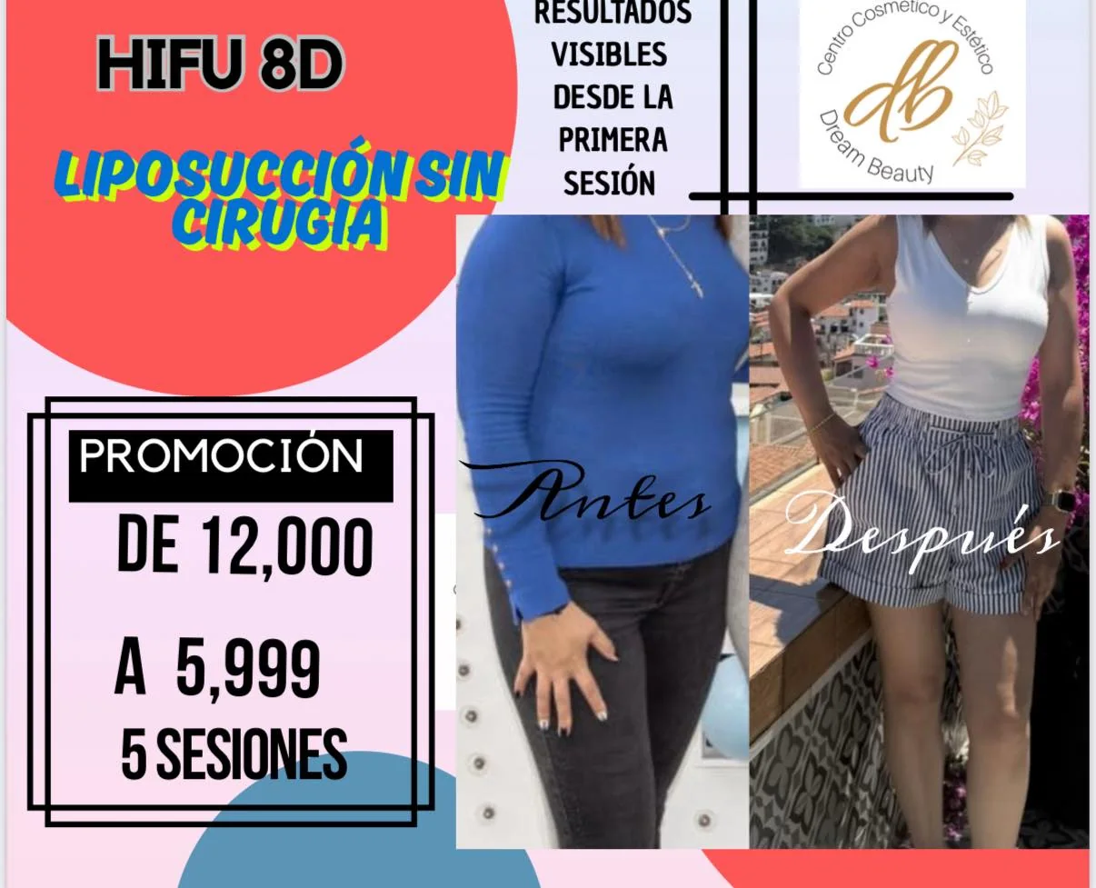 HIFU 8D liposucción sin cirugía