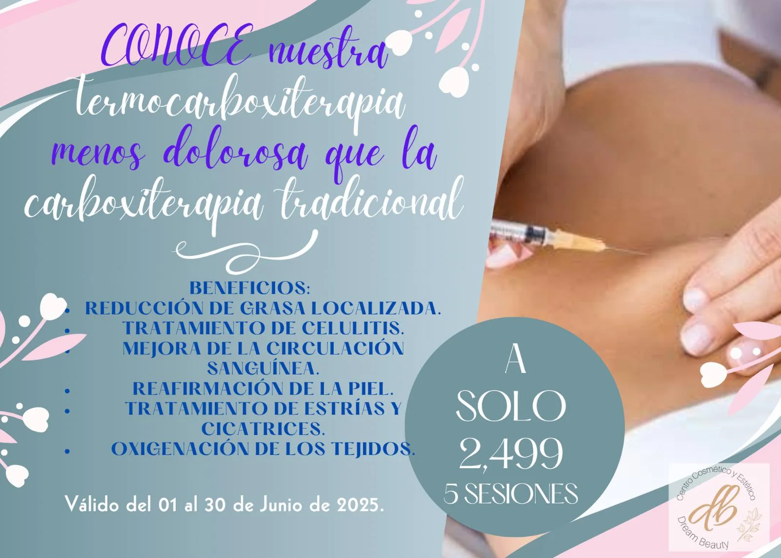 Termocarboxiterapia